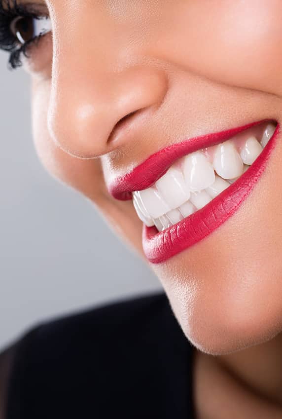 Teeth Whitening - Dene Lodge Dental